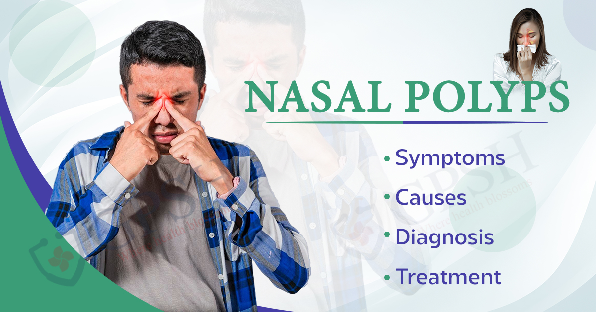 Nasal Polyps: Symptoms, Causes, Diagnosis and Treatment