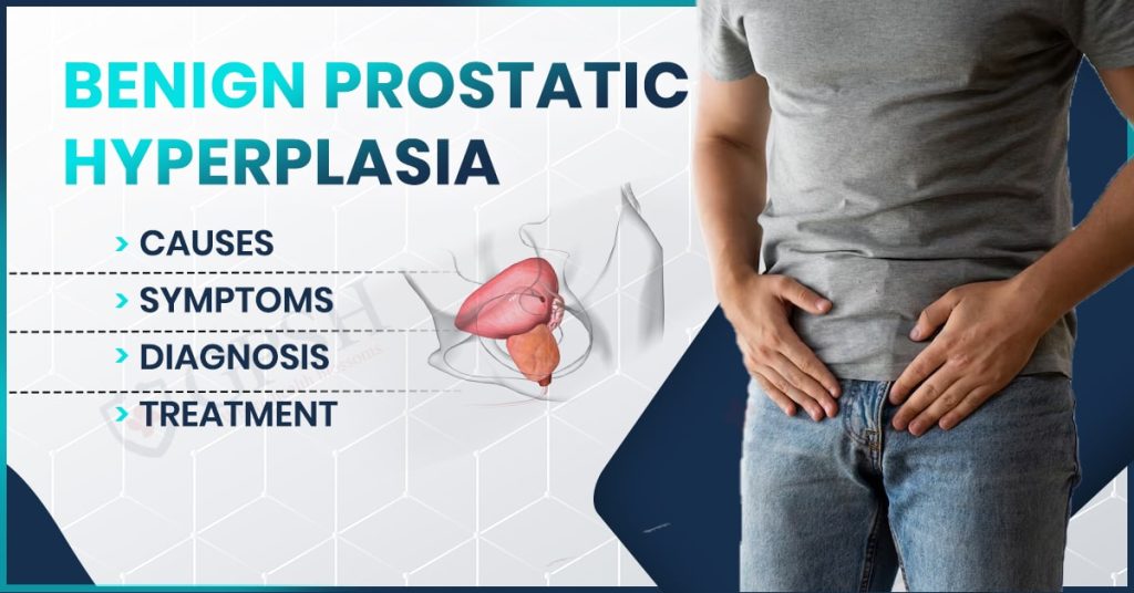 Benign Prostatic Hyperplasia