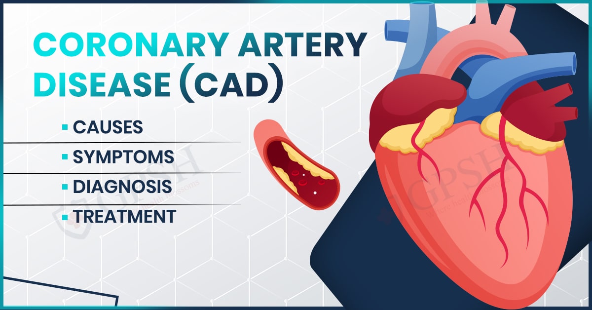 Coronary Artery Disease (CAD) – Causes, Symptoms, Diagnosis and Treatment