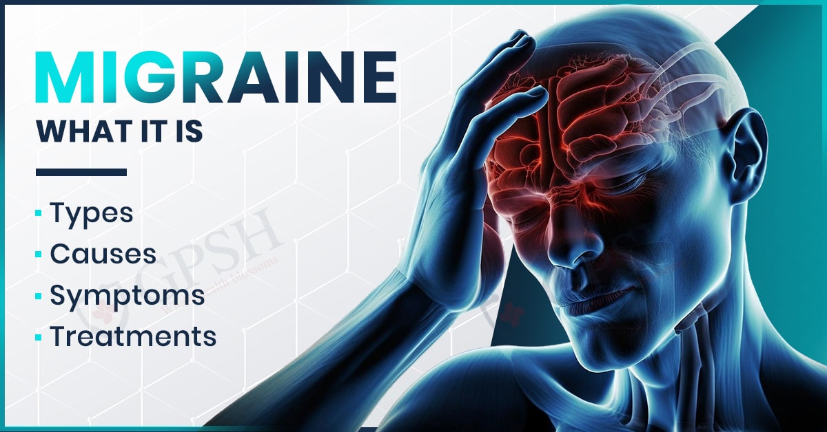 Migraine: What It Is, Types, Causes, Symptoms & Treatments