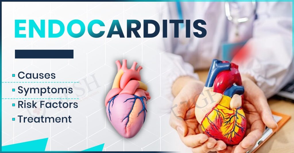 Endocarditis